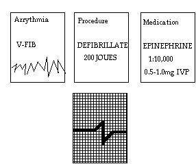 Assessing Arrhythmias